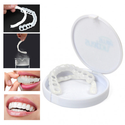 Snap On Smile - виниры