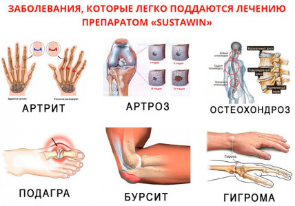 SUSTAWIN (Суставин) - средство для суставов