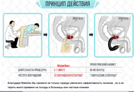 Prostata Help MP (Простата Хелп) - средство от простатита