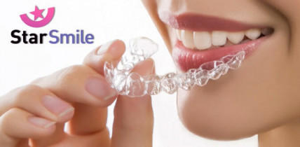SMILE STAR (Смайл Стар) - комплексное лечение зубов