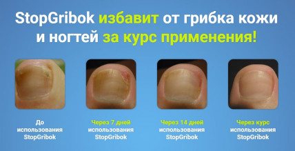 STOPGRIBOK (Стопгрибок) - от грибка кожи и ногтей