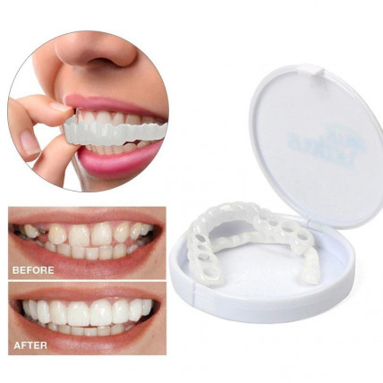 SNAP-ON SMILE - съемные виниры для красивой улыбки