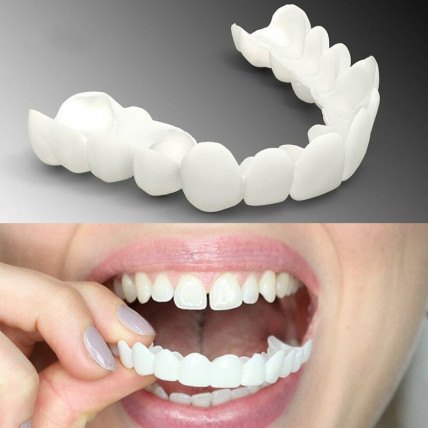 Snap On Smile - виниры