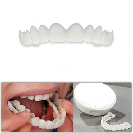 SNAP-ON SMILE - съемные виниры для красивой улыбки