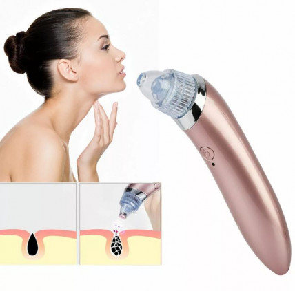 Beauty Skin Care Specialist - вакуумный очиститель кожи
