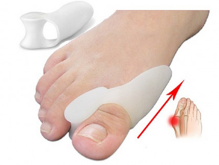 Valgus Pro (Валгус Про) - корректор против вальгусной деформации