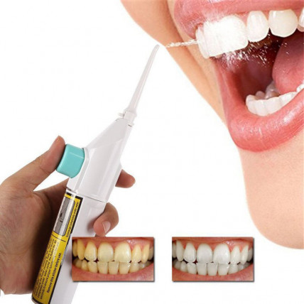 DENTAL SPA (Дентал СПА) - ирригатор для полости рта